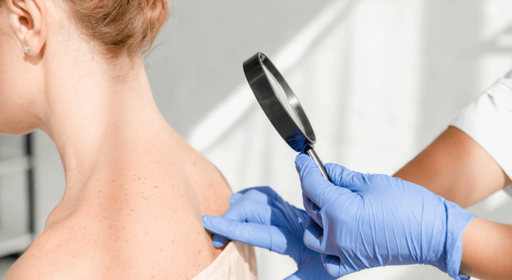 <strong>Pathologies cutanées</strong>